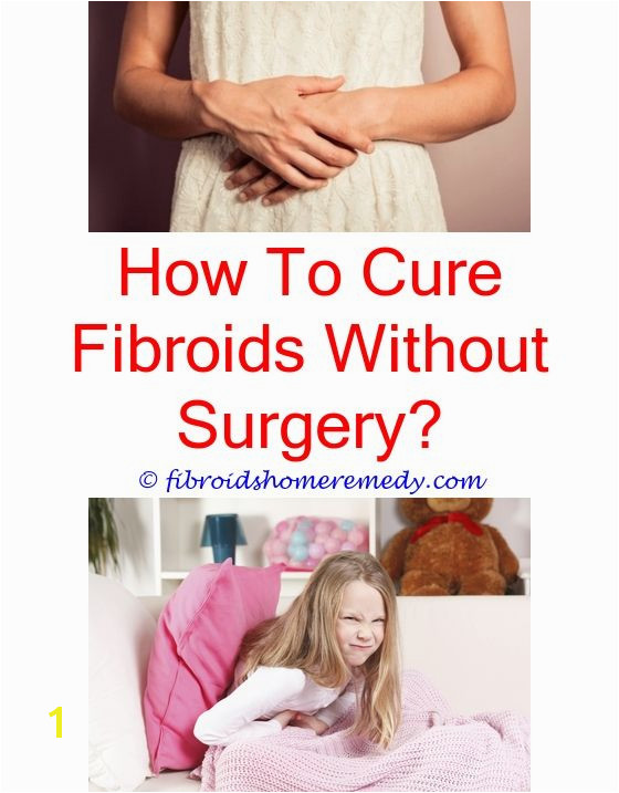 Mural Fibroid Non Cancerous Fibroids