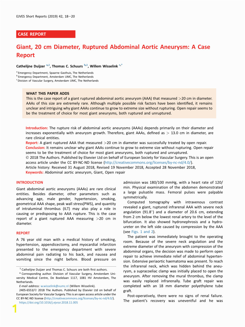 Mechanical wall stress in abdominal aortic aneurysm Influence of diameter and asymmetry