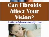 Mural Fibroid 551 Best Uterine Fibroid Size Chart Images